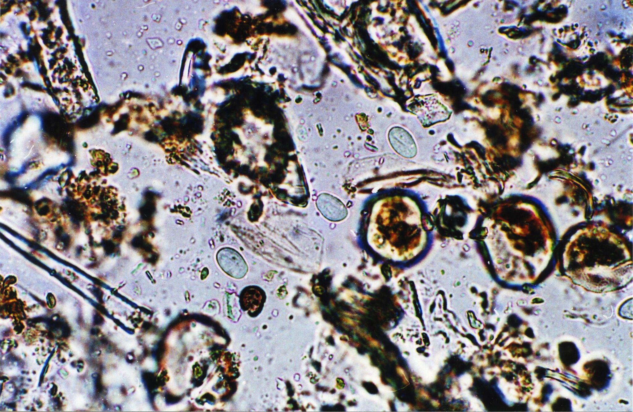 Microscopic view of microorganisms and sediment sample